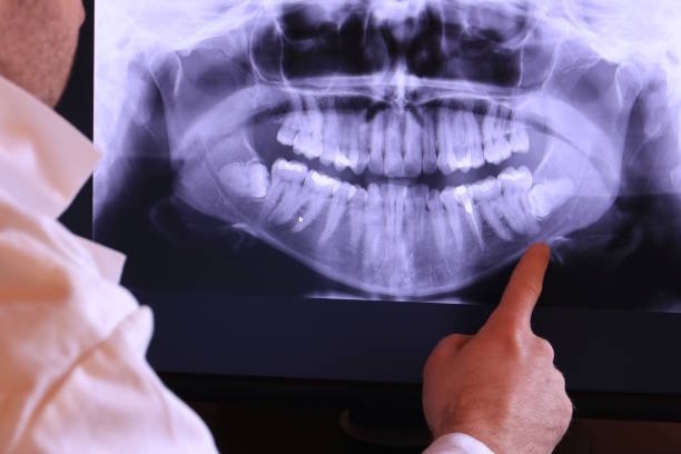 Best Emergency Denture Repair in Homer Glen, IL